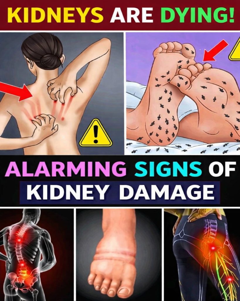 15 Deadly Kidney Signs You Must Catch Early