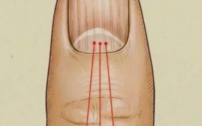 What to Eat to Reduce Nail Ridges: A Nutrition Guide for Healthier Nails