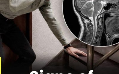 War:ning Signs of Aneurysm in Men: What You Should Never Ignore