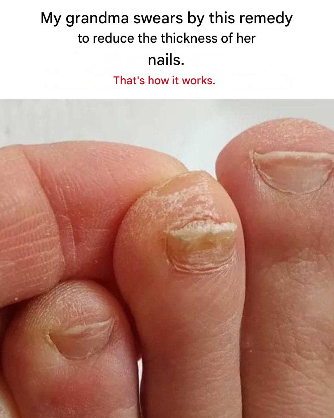 Trick to reduce toenail thickness