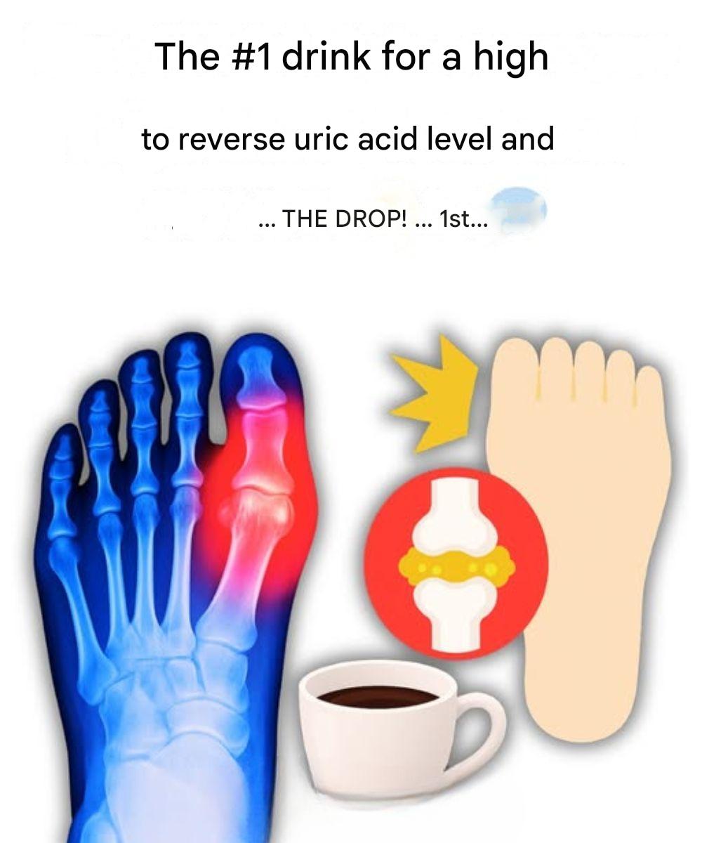 My big toe was on fire… Until I discovered these 5 drinks that naturally eliminate uric acid!