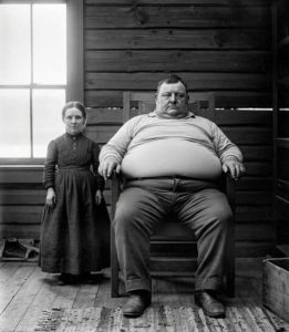 The woman was 1.2 meters tall, the man weighed 227 kg: Their 12 deformed babies shocked science (1897)