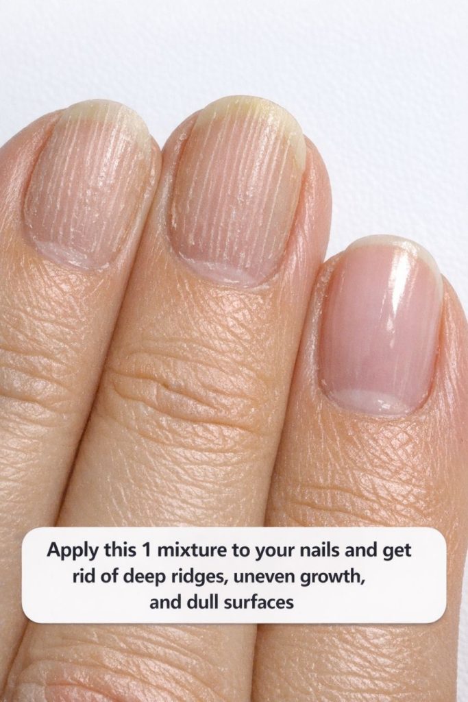 Apply this 1 mixture to your nails and get rid of deep ridges, uneven growth, and dull surfaces