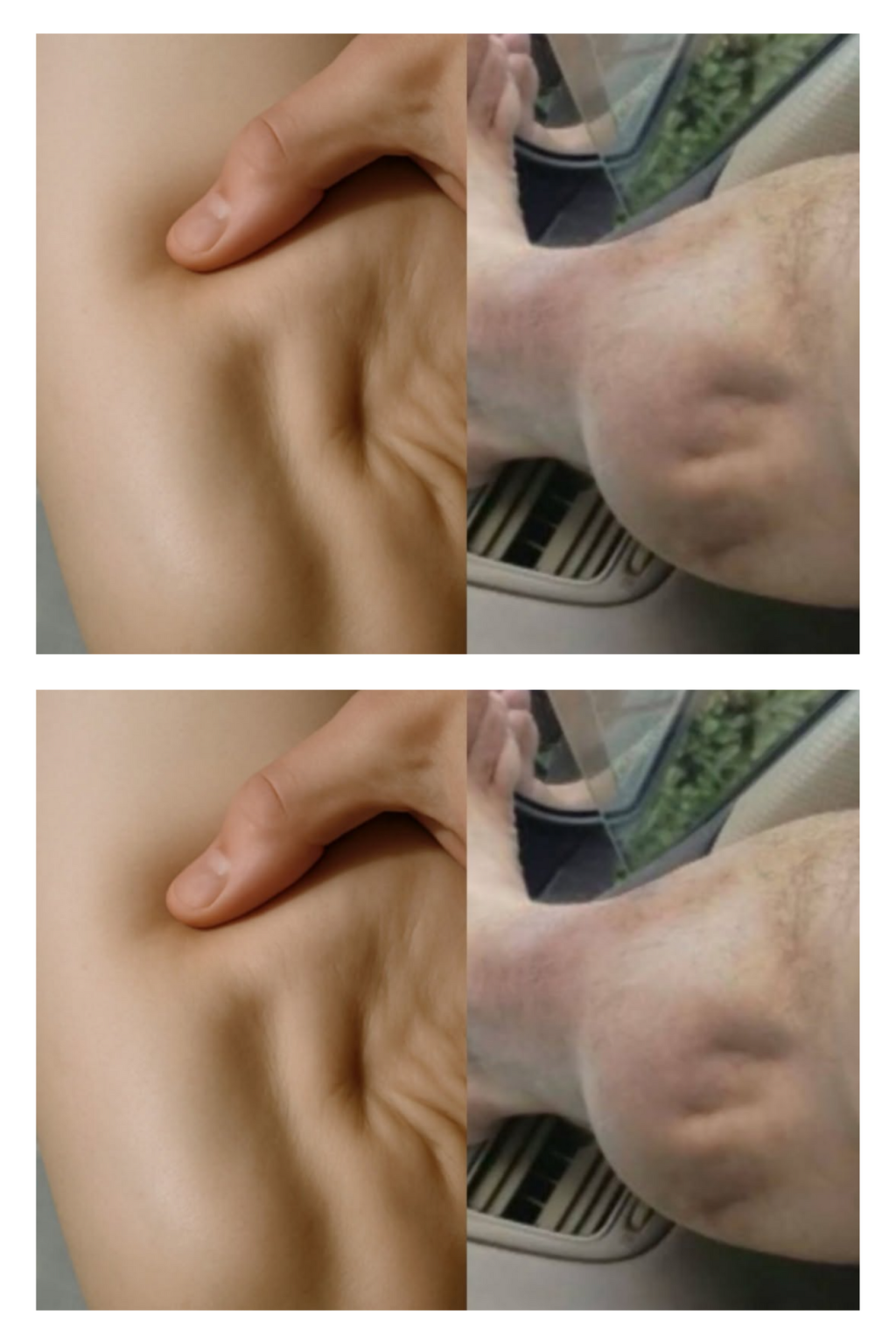 Waking up in the middle of the night, pierced by a sudden pain in your calf… It’s an experience many are familiar with. These nocturnal muscle spasms, often unexpected, disrupt sleep and leave an unpleasant feeling of stiffness. Fortunately, there are solutions to understand their origin and limit their occurrence.