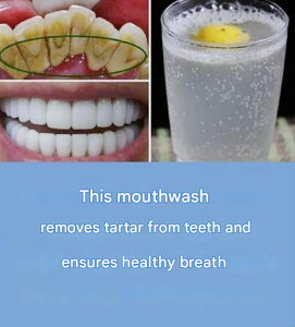 A natural method to remove plaque