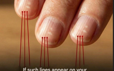 If vertical stripes appear on your nails after the age of 40, it may indicate the following symptoms: