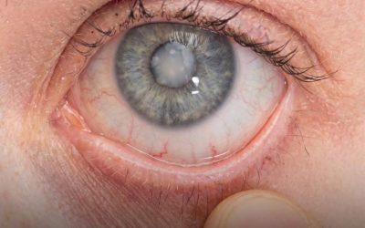 Are You Taking Any of These Medications? They Could Be Associated With This Disease…